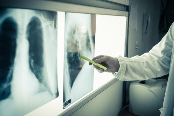 Radiology departments in Saudi Arabia improving efficiency with Vurke’s EOR and payroll services.
